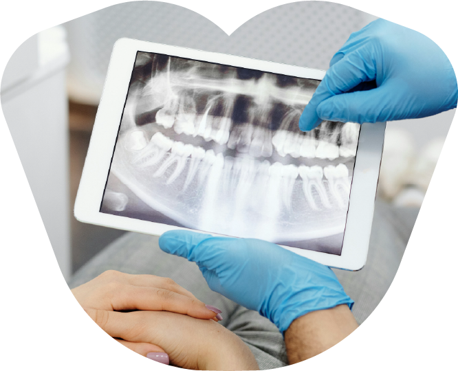 wisdom teeth extraction overview - Oral Surgeons in Fredericksburg TX